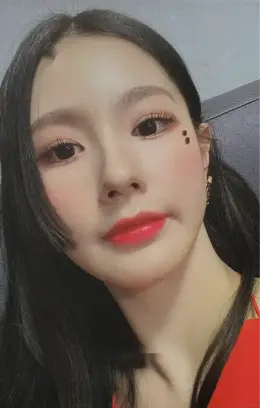 Miyeon · I Burn