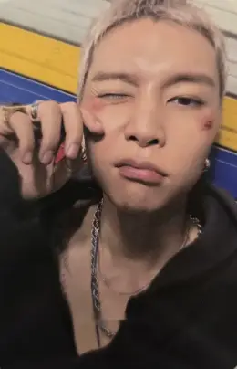Johnny · BLINGY